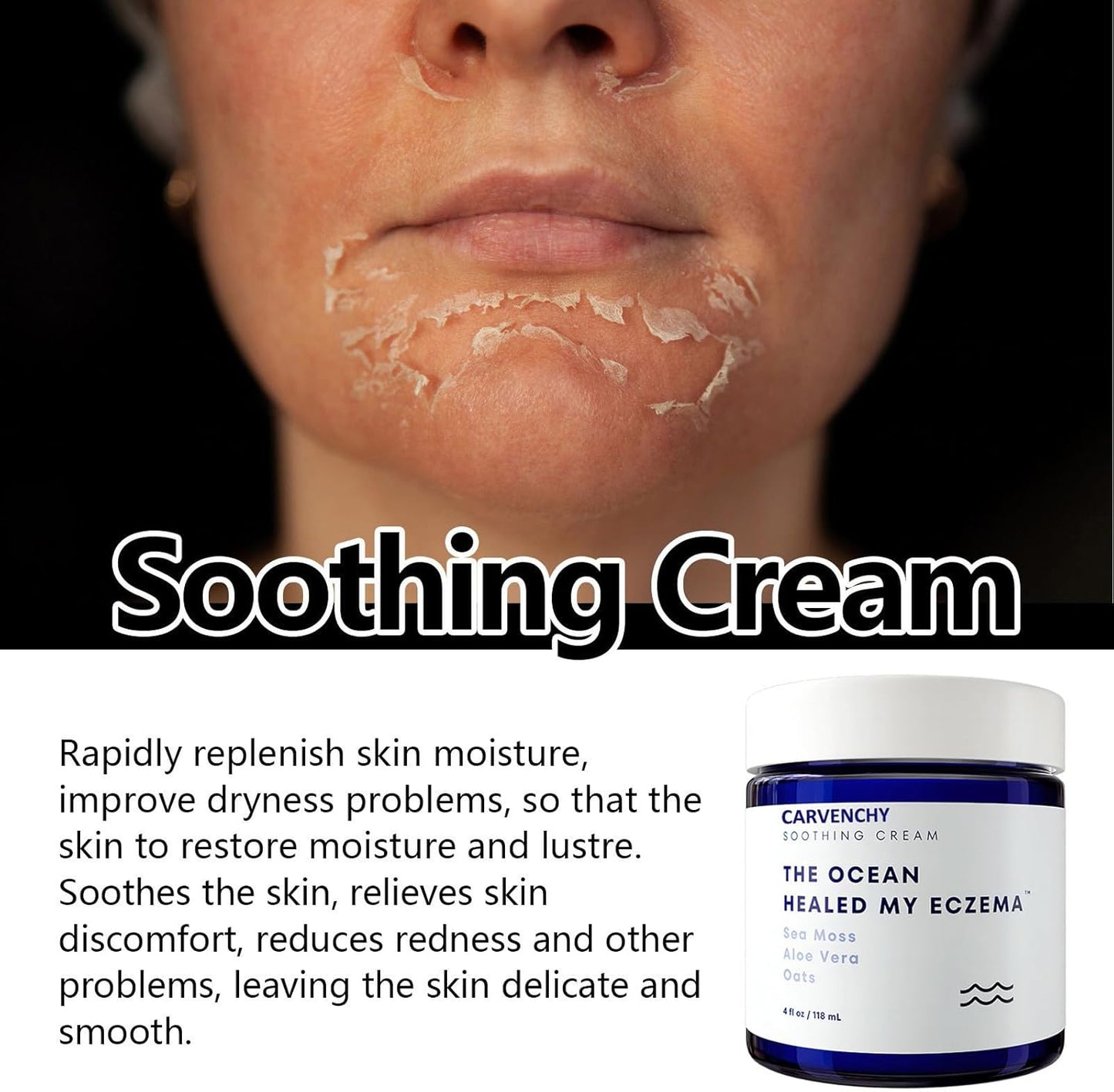 Carvenchy The Ocean Healed my Eczema Soothing cream with Aloe Vera and oaths -118ml