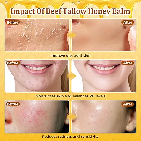 Neutrissent Beef Tallow for Skin Moisturizer with Beeswax and Honey-56.7g
